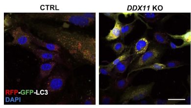cellule con assenza di proteina DDX11