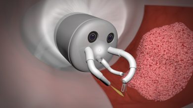 Robot Endotheranostics tumori del retto