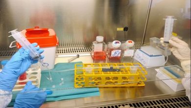 Ospedale Infantile Regina Margherita ricerca sarcomi ossei pediatrici